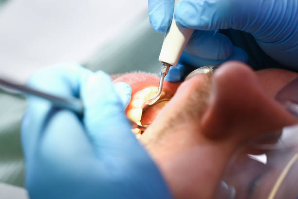 Best Dentist for Tooth Abscess  in Louisville, OH