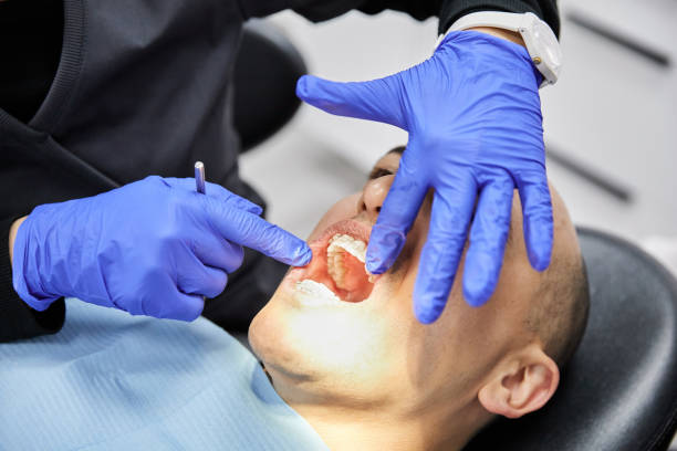 Best Dentist for Tooth Abscess  in Louisville, OH